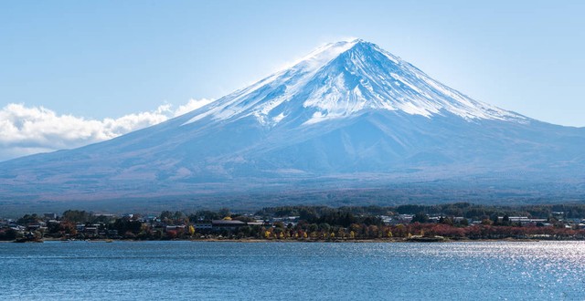 为什么去日本体检？揭开健康之旅的秘密，探索长寿之国的神奇医疗技术！